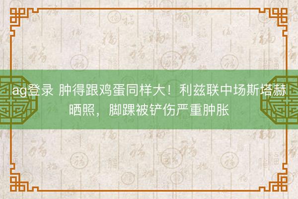 ag登录 肿得跟鸡蛋同样大！利兹联中场斯塔赫晒照，脚踝被铲伤严重肿胀