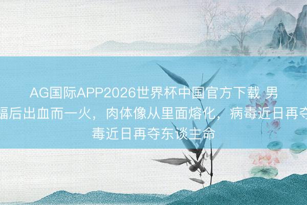 AG国际APP2026世界杯中国官方下载 男孩煮食蝙蝠后出血而一火,肉体像从里面熔化,病毒近日再夺东谈主命